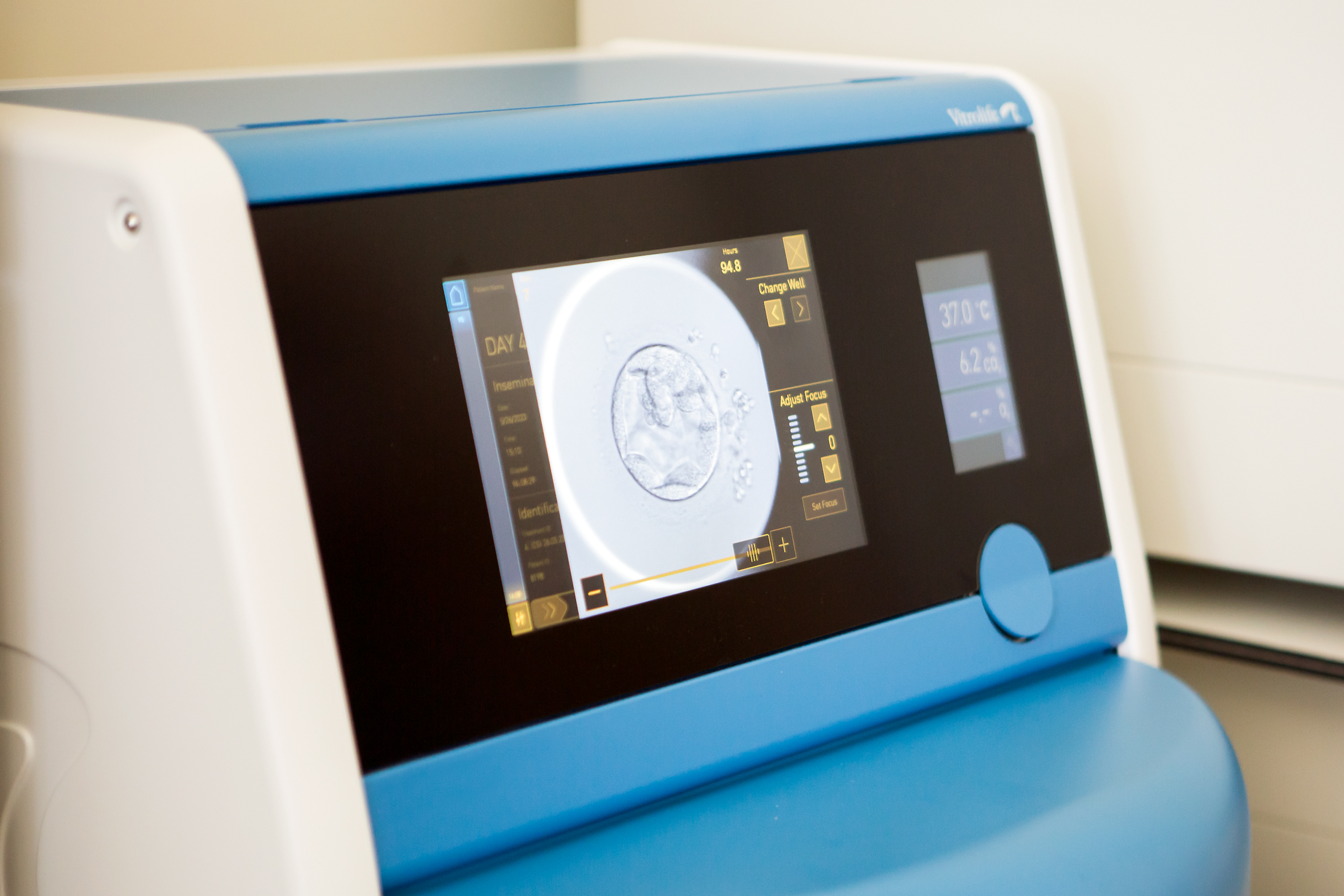 Embryoscope von Vitrolife wird zur ungestörten Inkubation (Timelapse) verwendet